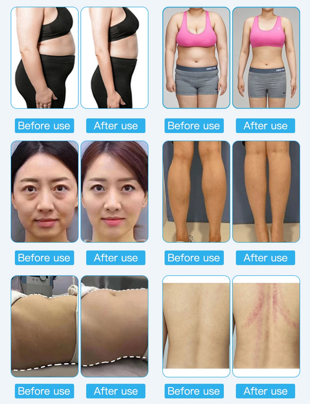 New 80k 40Khz Ultrasonic Cavitation Lipo Laser Rf Vacuum 5D Fat Slimming Beauty Weight Loss Machine with EMS Pad