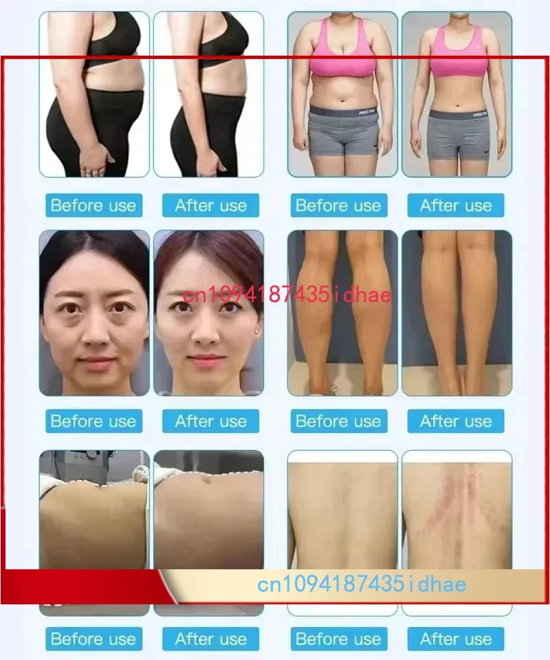 Cavitation Machine 6 in 1, 80K fa Burner, Weight Loss, Atombers GR Corporel, 80 kPopméthanol